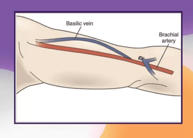 Rectangle 22 https://www.epitomehospitals.com/wp-content/uploads/2023/11/Rectangle-22.png