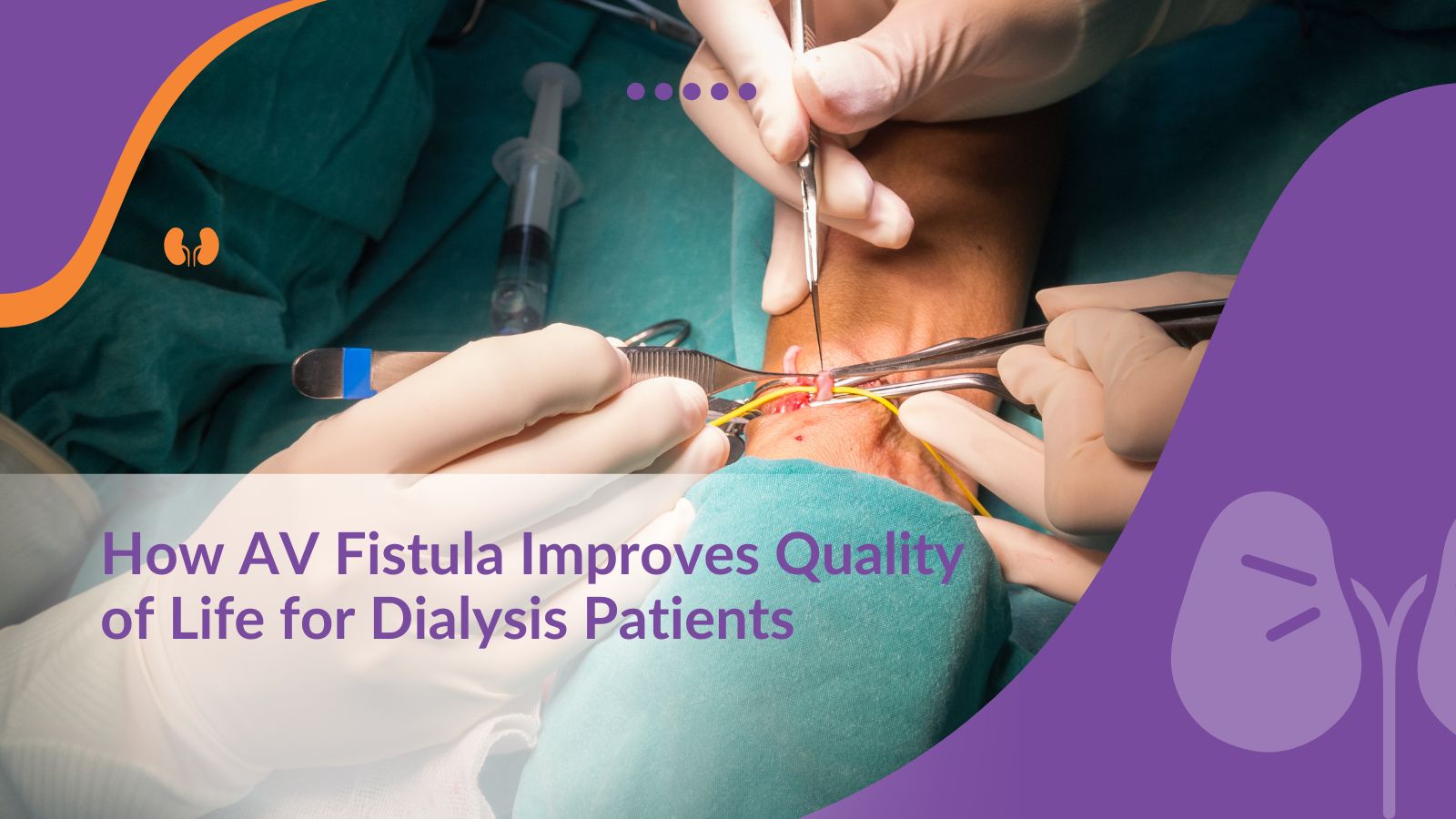 How AV Fistula Improves Quality of Life for Dialysis Patients