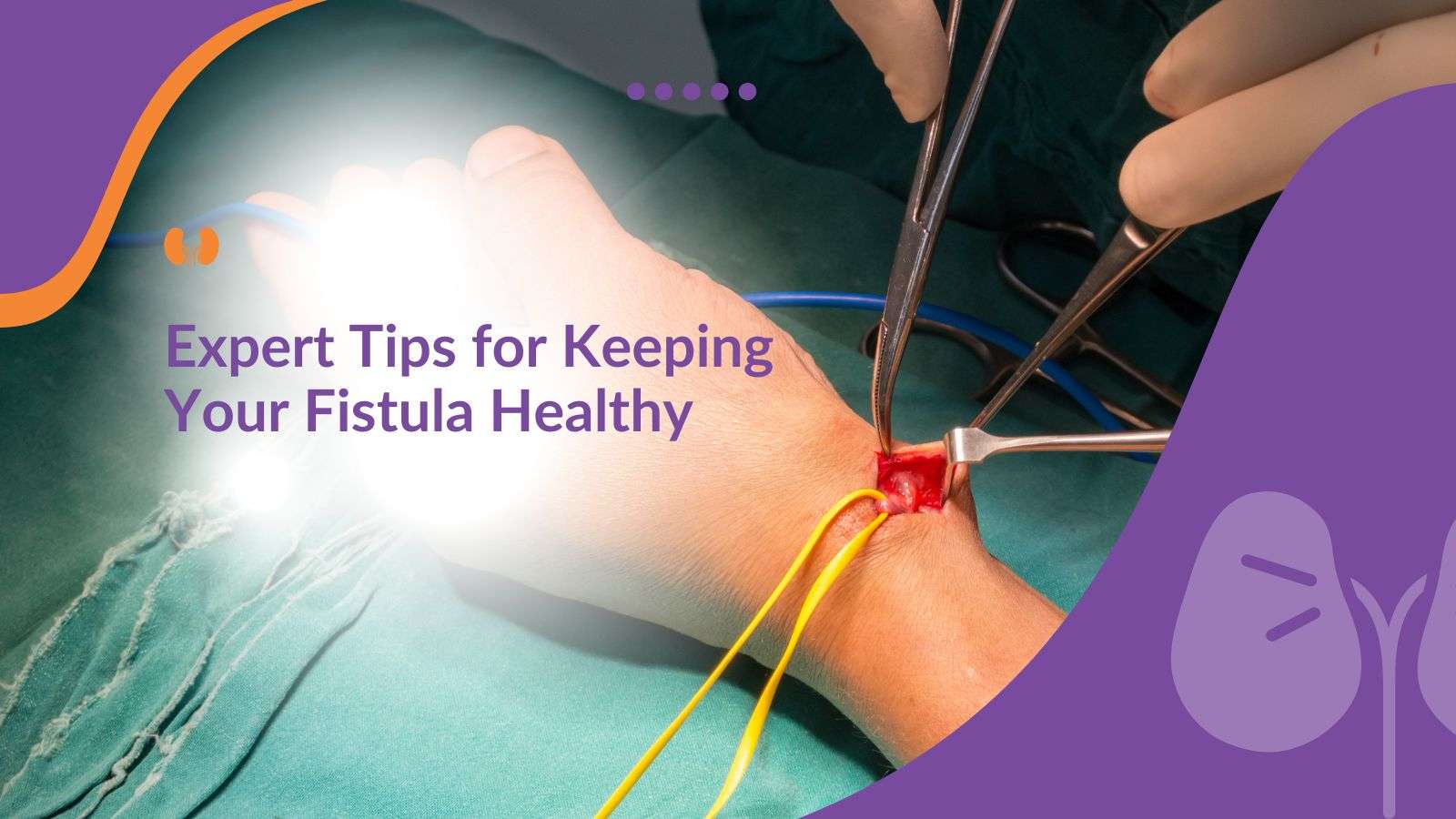 Expert Tips for Keeping Your Fistula Healthy