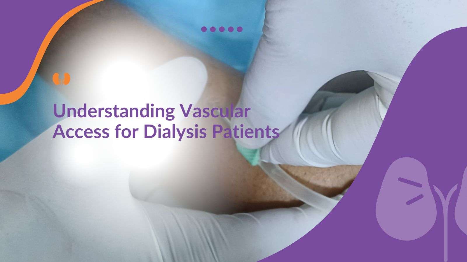 Understanding Vascular Access for Dialysis Patients
