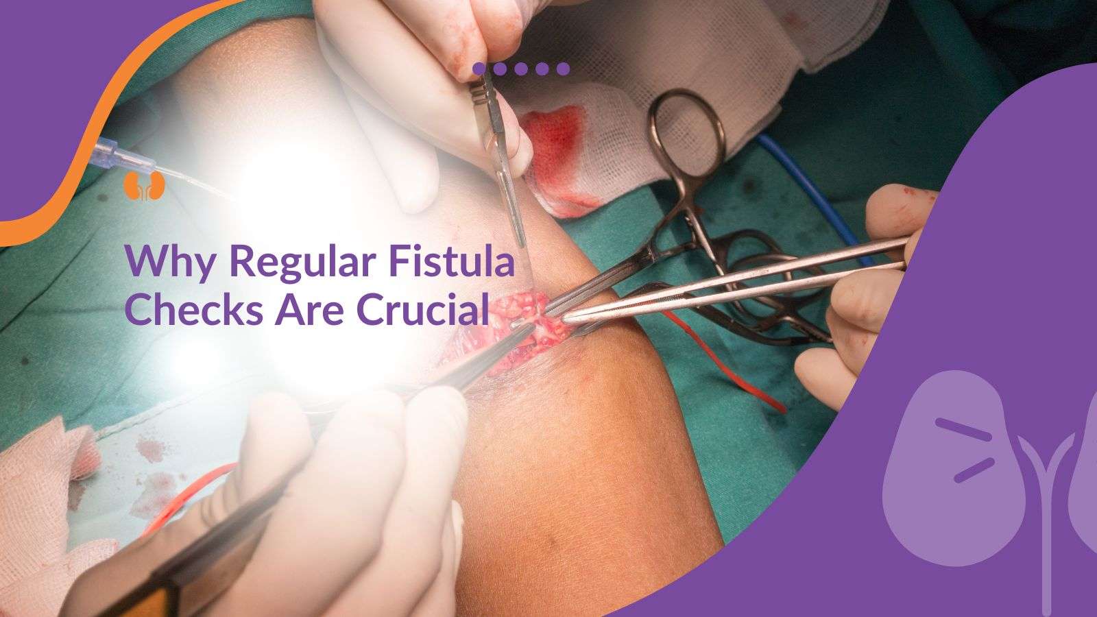 Why Regular Fistula Checks Are Essential